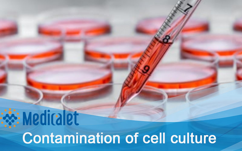 Contamination of cell culture